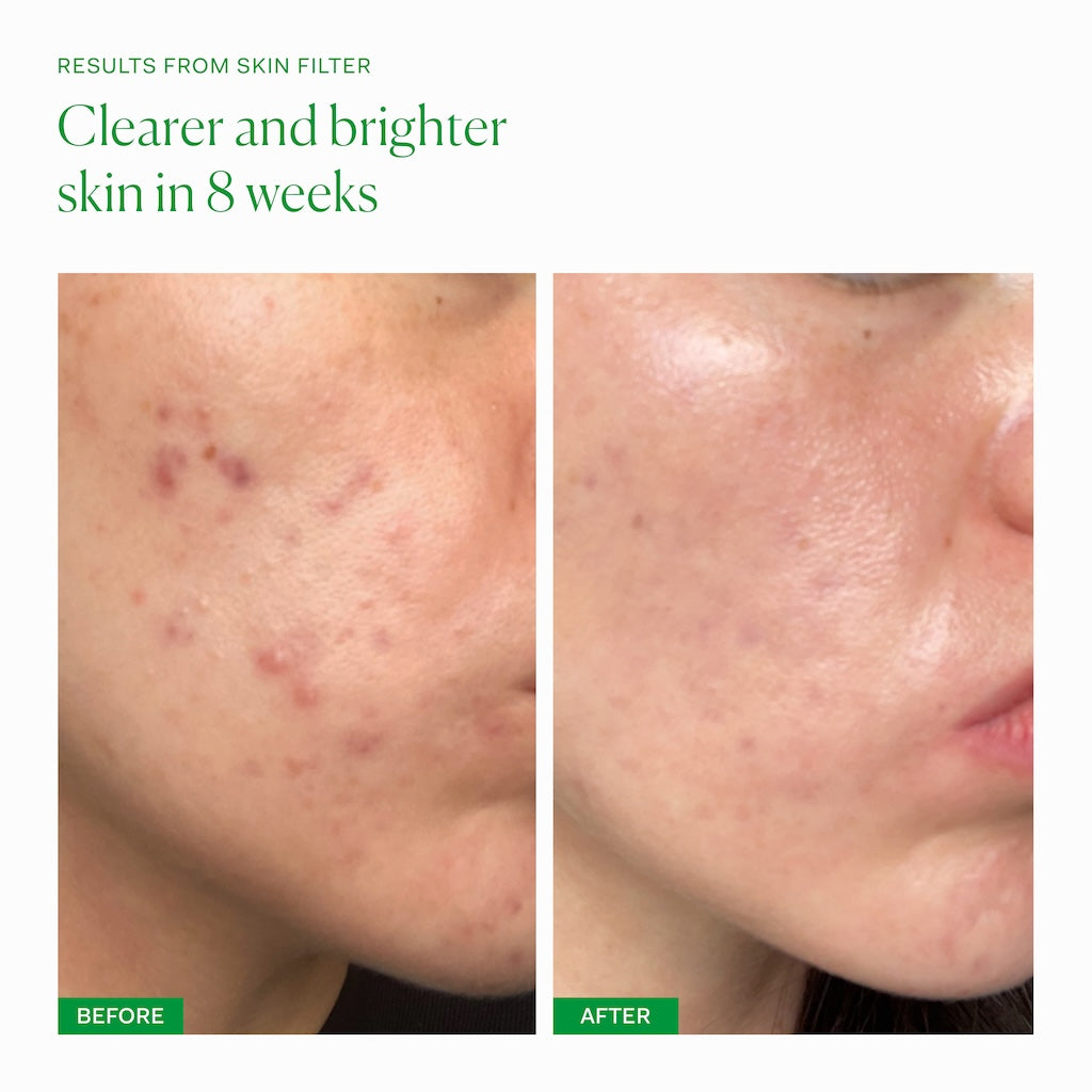 Skin Filter Capsules