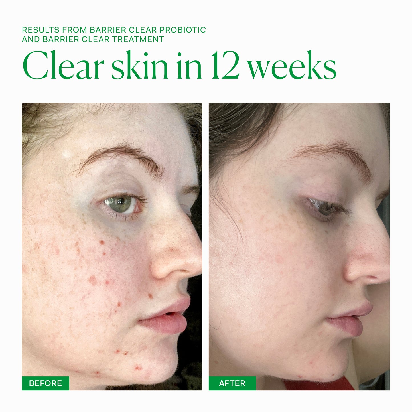 Barrier Clear Probiotic Capsules